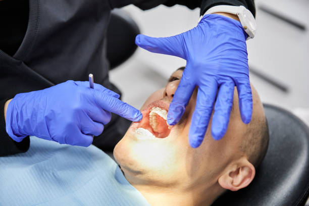 Best Emergency Wisdom Tooth Extraction in Greenfield, MO